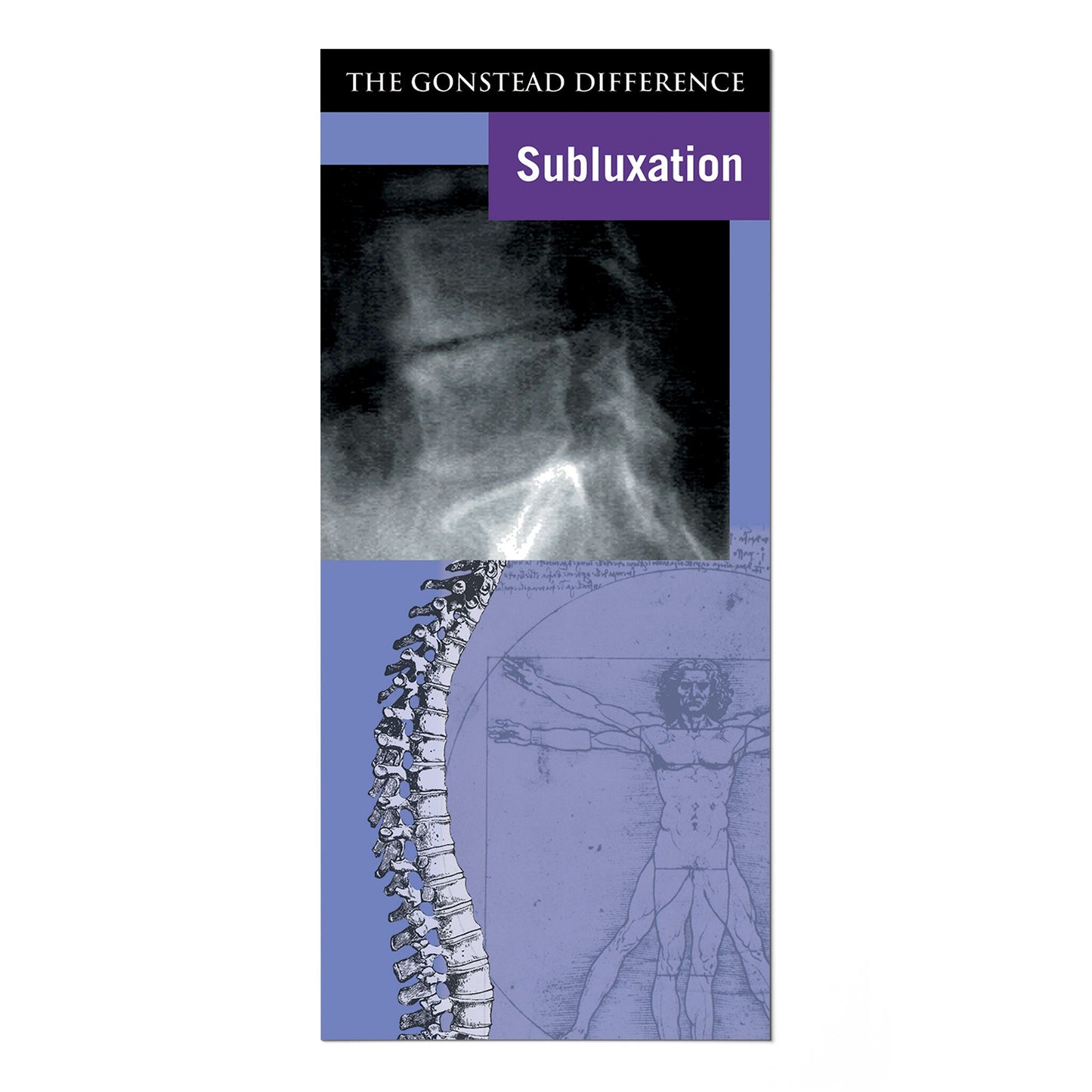 Subluxation